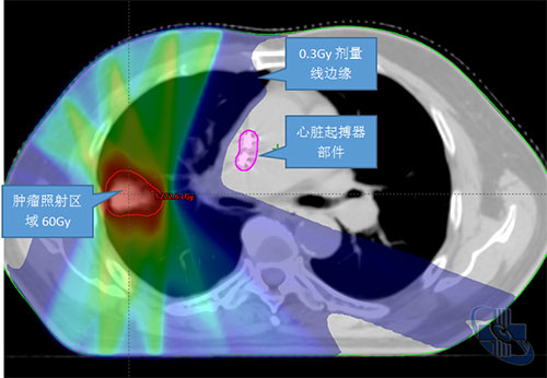 圖片2.jpg